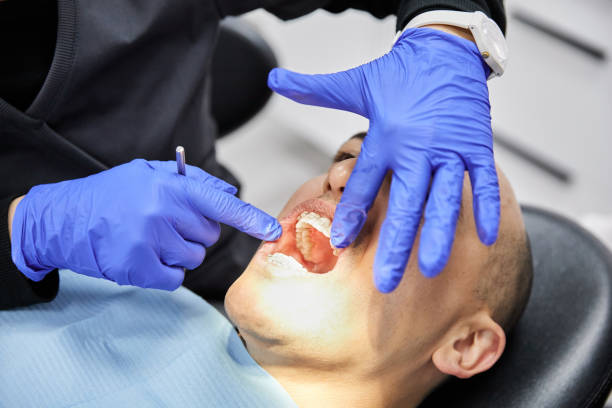 Best Emergency Dental Care for Broken or Chipped Teeth in Mannington, WV